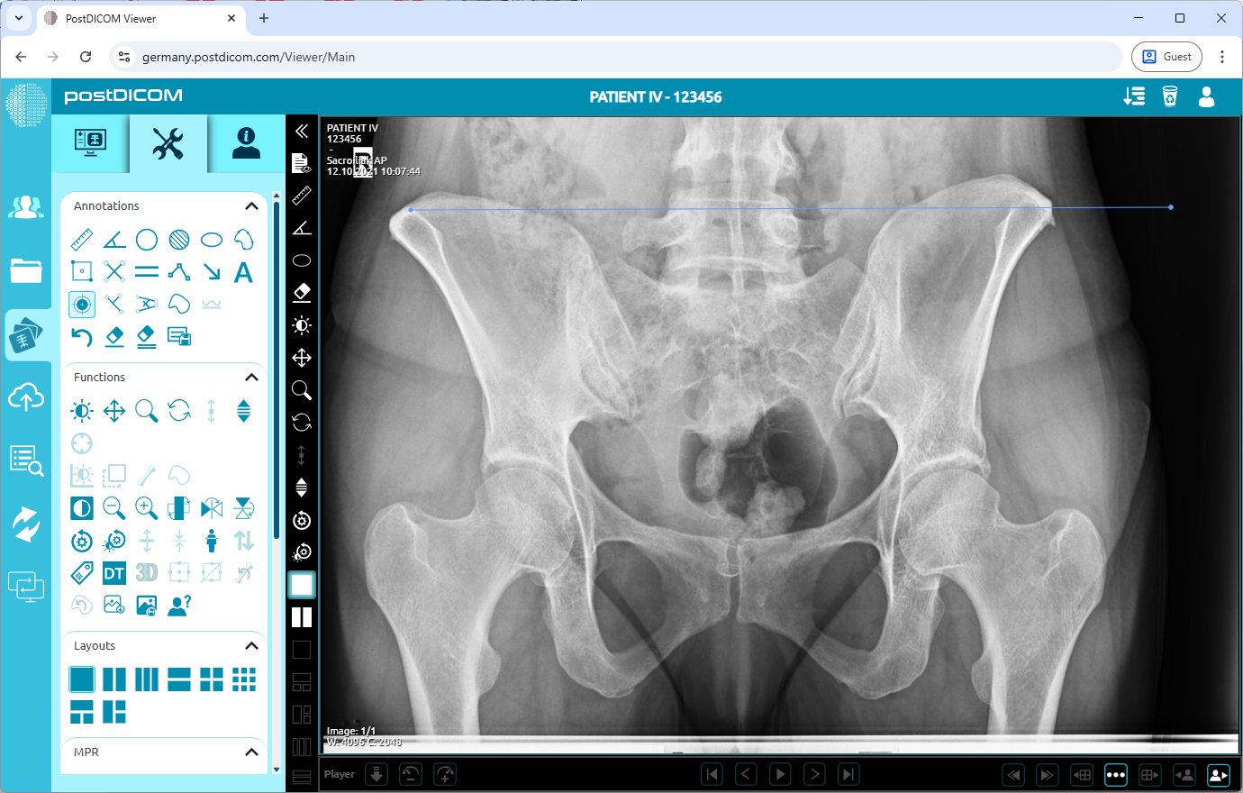 Using Calibration Tool